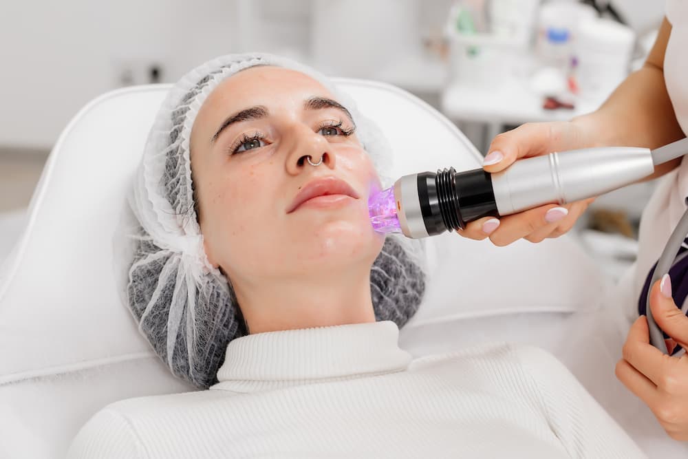 A woman lies in a treatment chair while a provider performs an RF microneedling procedure on her face using a handheld device emitting purple light.