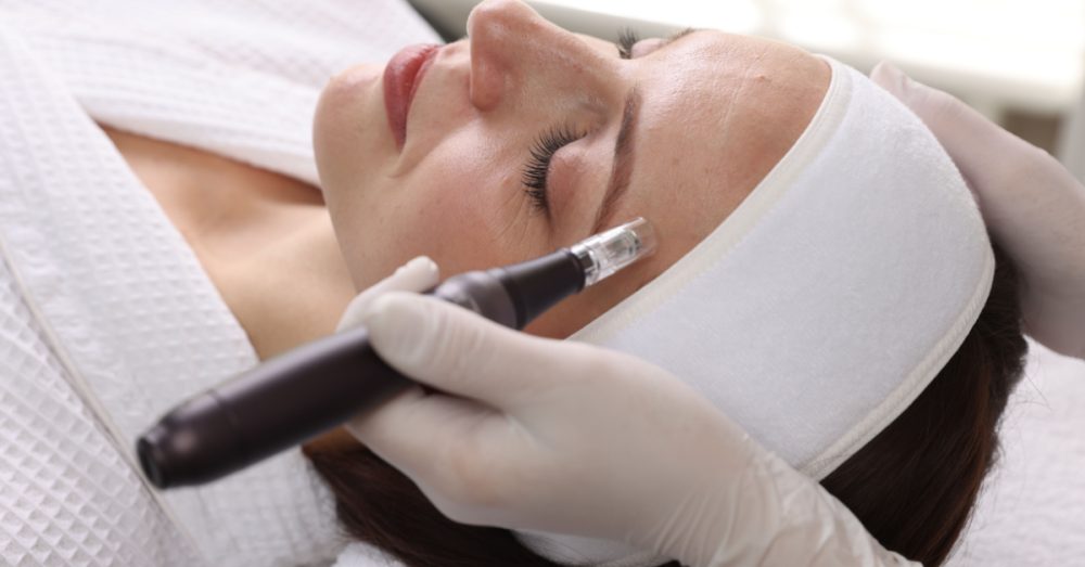 Provider performing microneedling treatment on a woman’s face